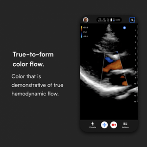 Butterfly iQ+ Vet Ultrasound System (Lightning)