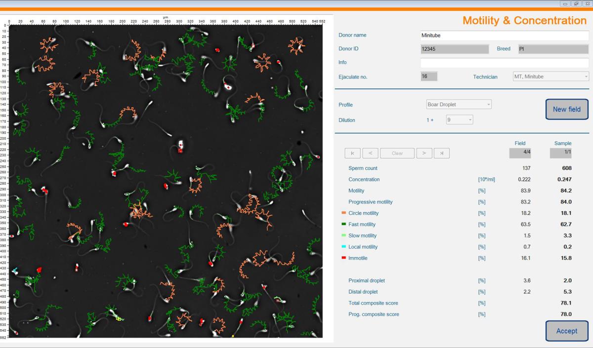 ANDROVISION® SOFTWARE MODULE: AUTOMORPH, RECOMMENDED FOR