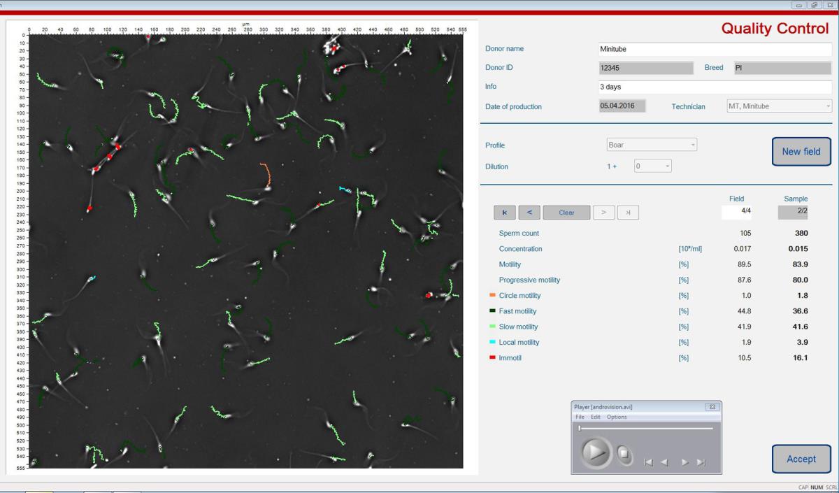 ANDROVISION® SOFTWARE MODULE: QUALITY CONTROL OF HOLDING