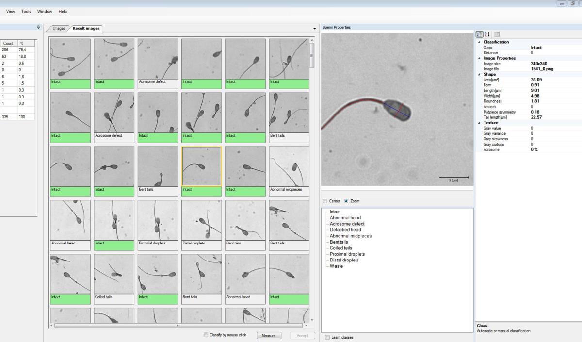 ANDROVISION® SOFTWARE MODULE: MORPHOLOGY & MORPHOMETRY