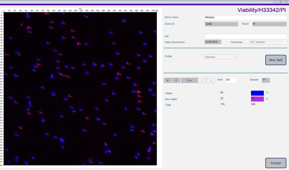 ANDROVISION® SOFTWARE MODULE: VIABILITY (MEMBRANE INTEGRITY