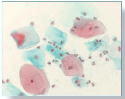 SHORR S STAIN, 500 ML
