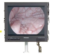 FLAT SCREEN 24" (58 CM) FOR ANDROVISION® CASA AND OTHER APP