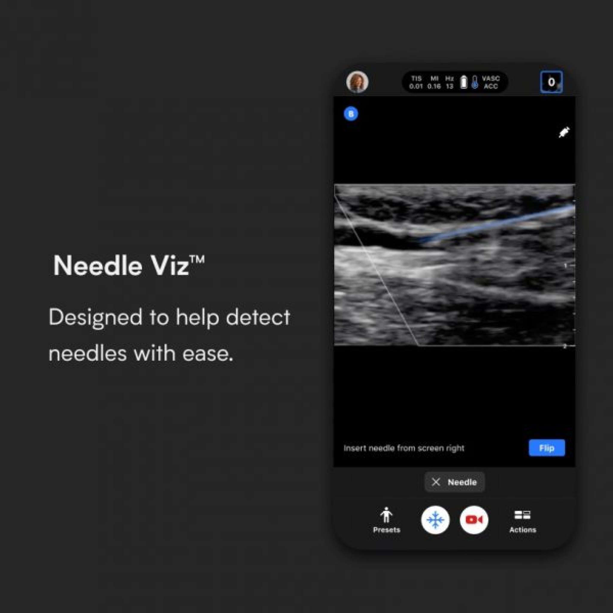 Butterfly iQ+ Vet Ultrasound System (Lightning)