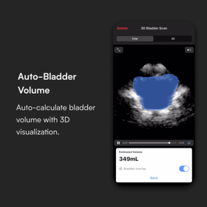 Butterfly iQ+ Vet Ultrasound System (USB-C)