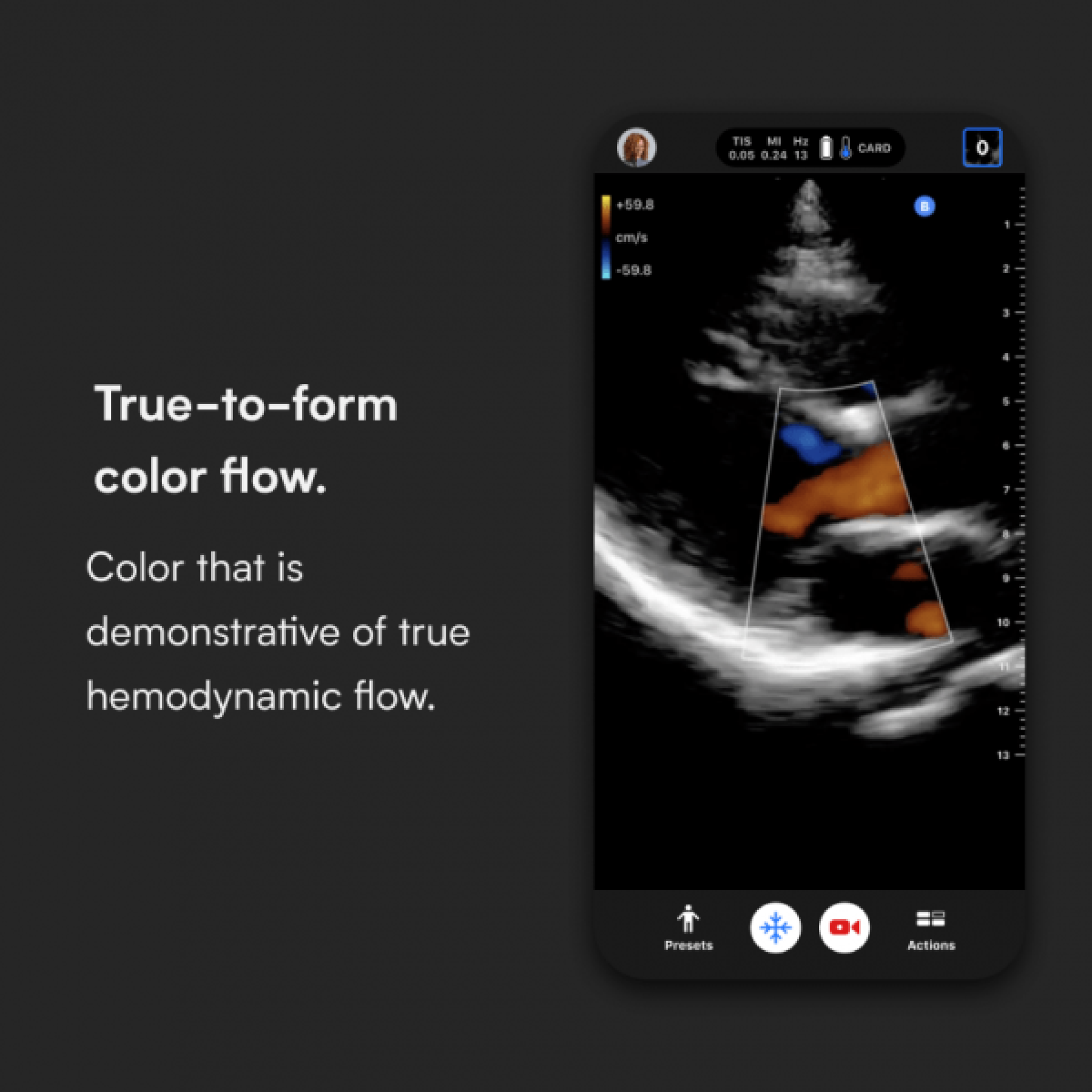 Butterfly iQ+ Vet Ultrasound System (USB-C)