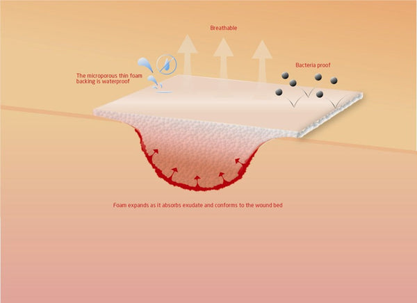 KRUUSE Foam Dressing sterile 5 x 5cm