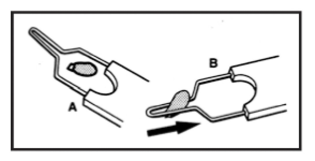 Tick Picker - Shopivet.com