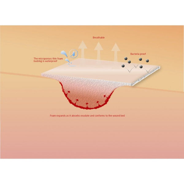 KRUUSE FOAM DRESSING STERILE 5 X 5CM - Shopivet.com